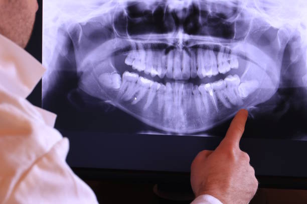 Best Emergency Dental Extractions in Devens, MA