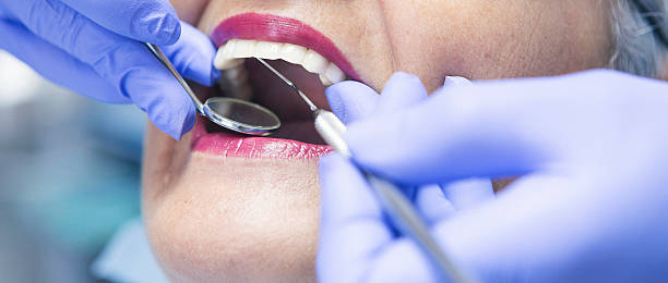 Best Emergency Dentist for Lost Fillings or Crowns in Devens, MA
